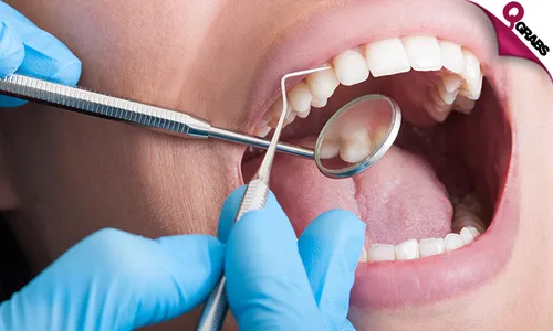 Dental Scaling & Polishing, Fluoride Application, Composite Filling & More!